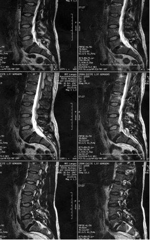Arcada examensarbete picture